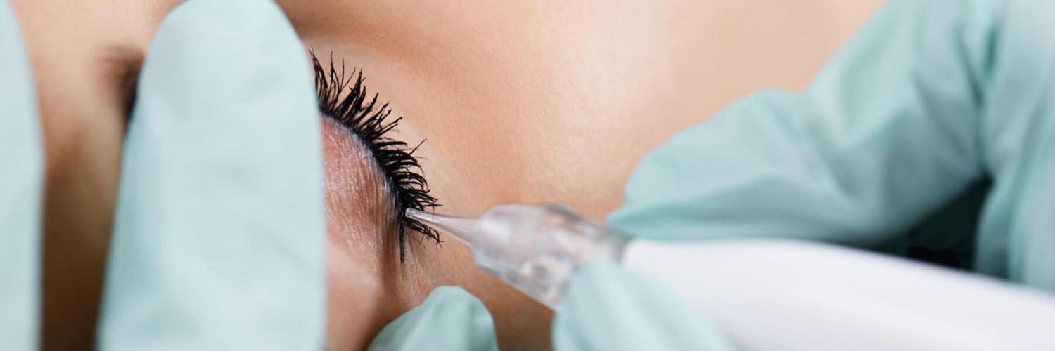 Permanent Make-up für Wimpernkranz und Lid